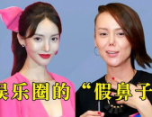 娱乐圈的假鼻子,明星假鼻子的秘密大起底